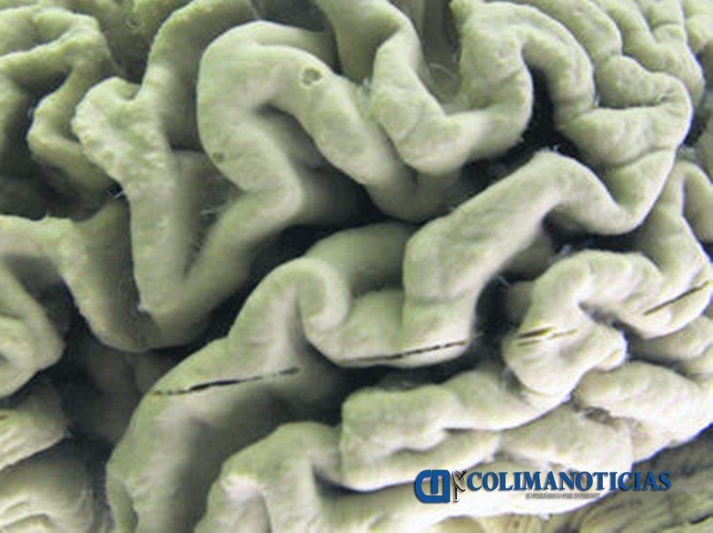 Cambios en estilo de vida retrasan el Alzheimer