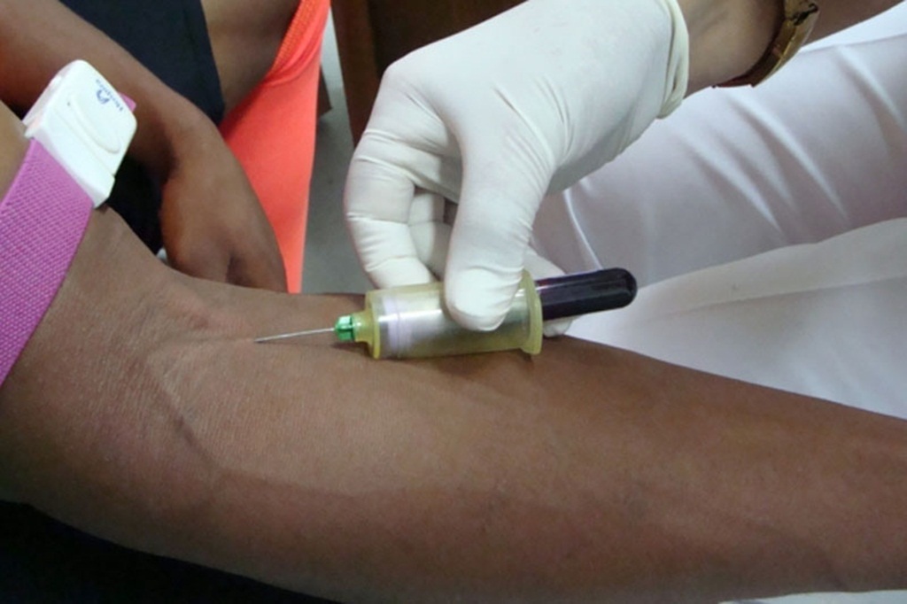 cáncer de próstata y obesidad