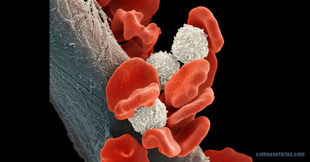 Conoce los síntomas del cáncer en la sangre