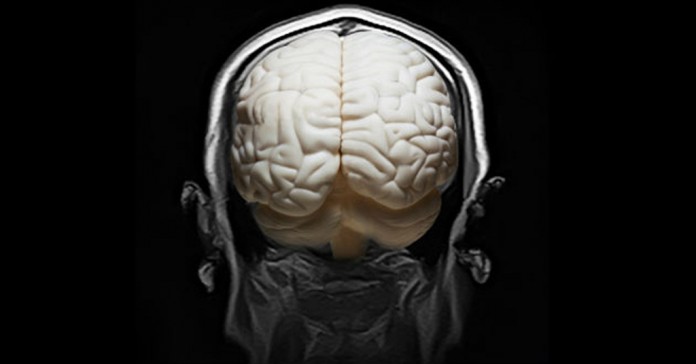 cerebro