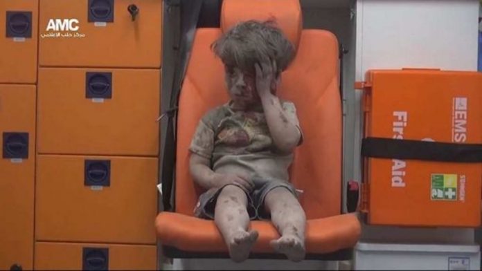 niño rescatado tras bombardeo