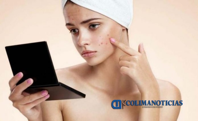 acne ducha