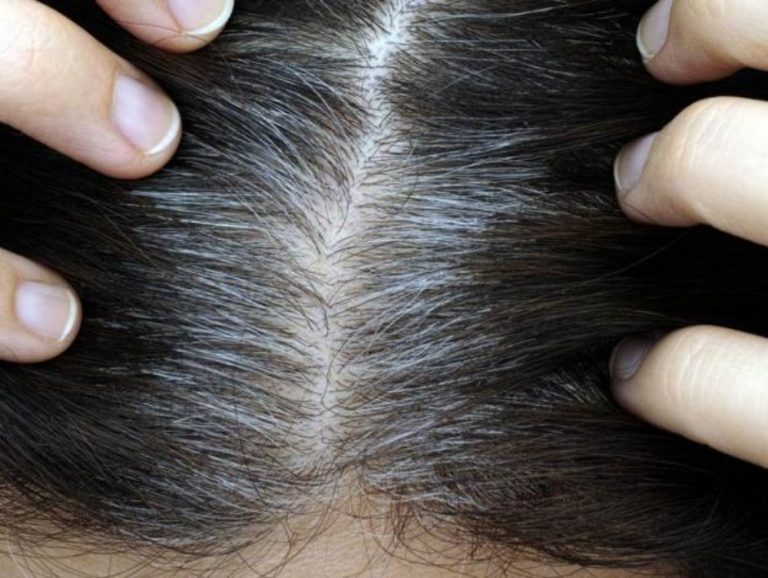 Genética, la verdadera “culpable” de tus canas