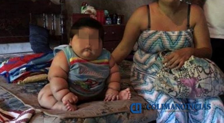 Pequeño de Tecomán con sobrepeso excesivo podría recuperar la salud