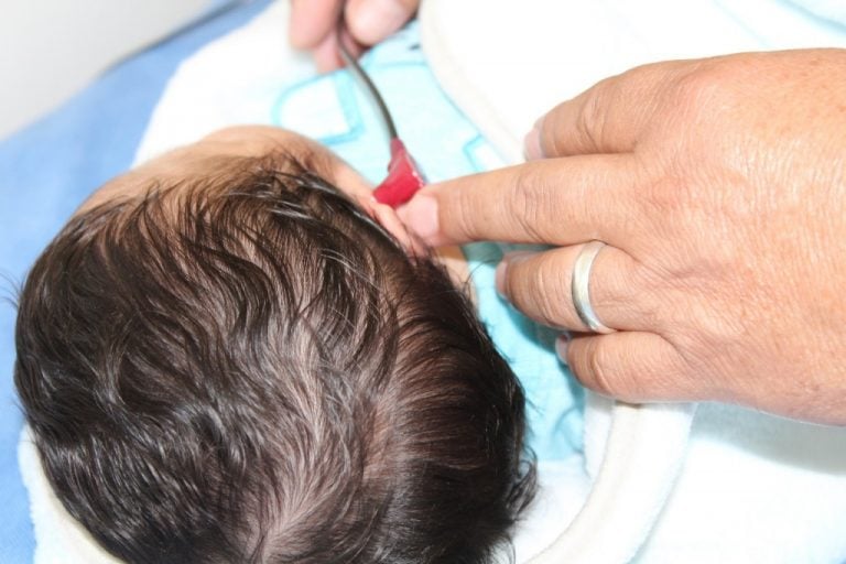 DIF Estatal promueve Campaña de examen de Tamiz Auditivo Neonatal
