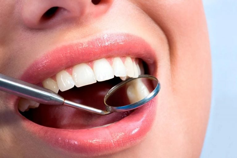 Remedios naturales para prevenir las caries