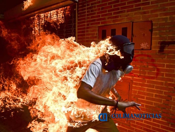 World Press Photo 2018 venezuela
