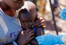 Más de 2 mil muertes en el Congo por brote de sarampión