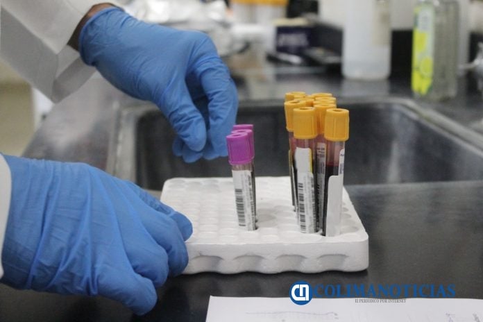 covid laboratorio