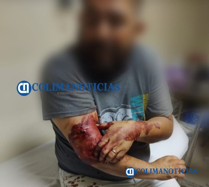 Taxista es asaltado y herido con arma blanca