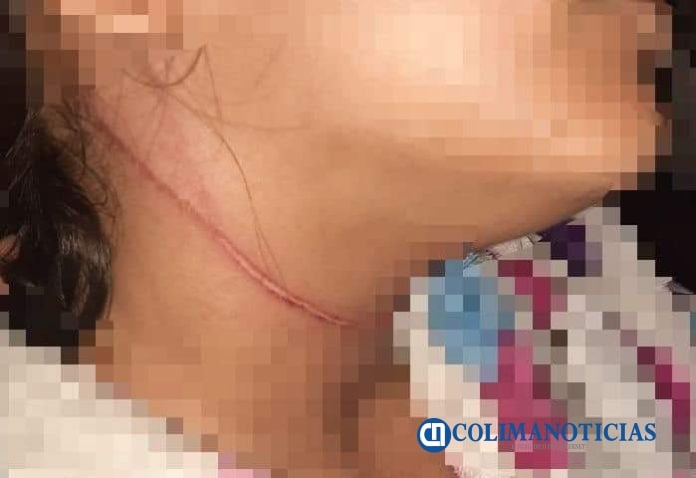 menor a punto de degollarse