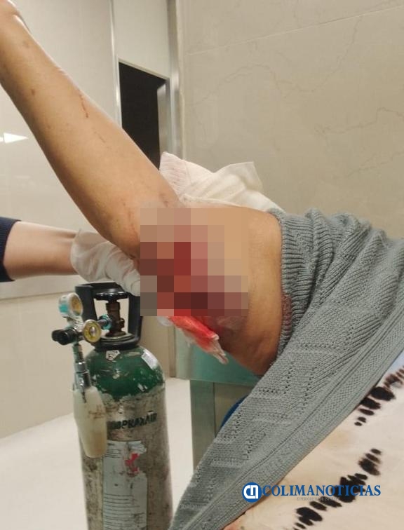 Mujer armeritense denuncia ataque de perro peligroso