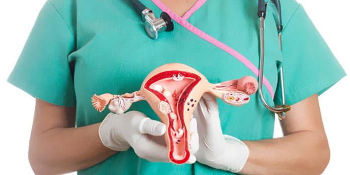 Colima con el mayor porcentaje de casos de cáncer cervicouterino
