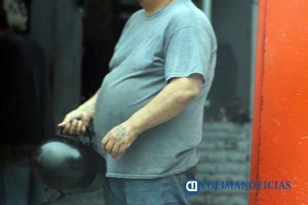 Obesidad en abdomen
