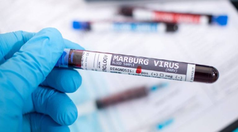 Confirman brote del virus de Marburgo en Etiopía