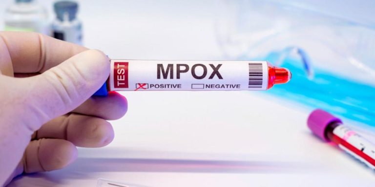 Identifican una nueva cepa de mpox en Inglaterra