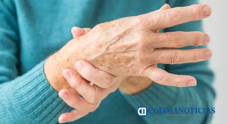 Osteoartritis afecta a seis de cada 10 mexicanos y empeora con el frío