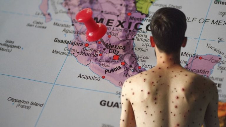 Sube a 32 la cifra de muertes por sarampión en México