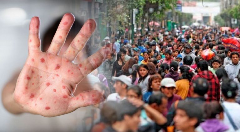 Suman más de mil 200 casos de sarampión en México durante 2026