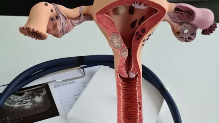 Asociación mexicana urge atención prioritaria al cáncer de ovario