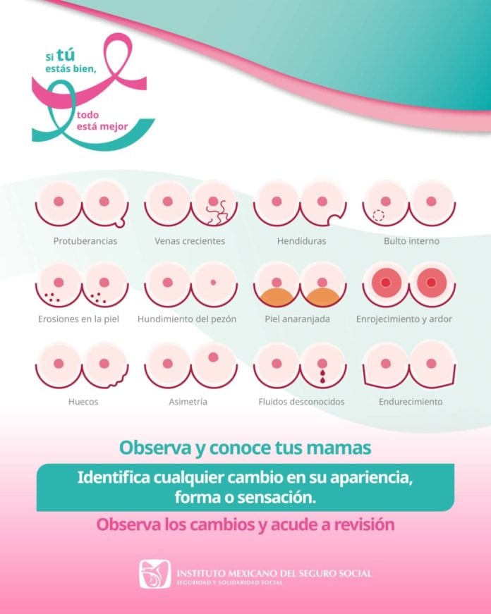 Acerca IMSS Colima acciones preventivas para la detección oportuna del cáncer de mama (2)